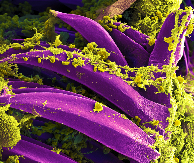 Illustration for article titled The Astounding And Horrific World As Seen Under A Microscope
